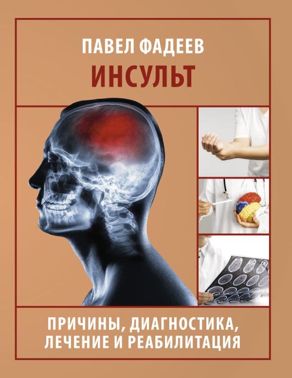 Обложка книги Инсульт. Причины, диагностика, лечение и реабилитация — Фадеев П.А.